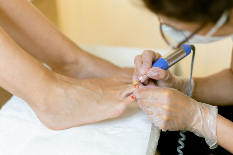 Tratamento a Laser para Micose: Como a Podologia Pode Ajudar na Sua Recuperação Tratamento a Laser para Micose: Como a Podologia Pode Ajudar na Sua Recuperação