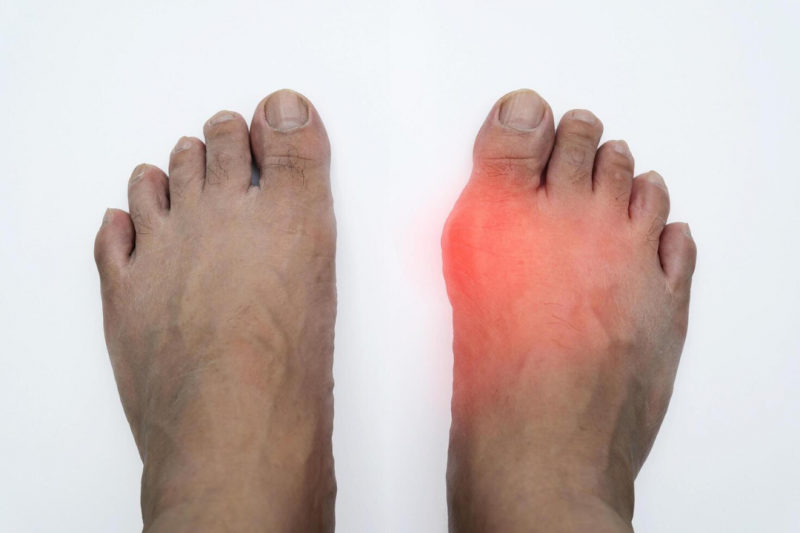 Tratamento com Laser em Podologia: A Solução Eficaz para Seus Problemas nos Pés