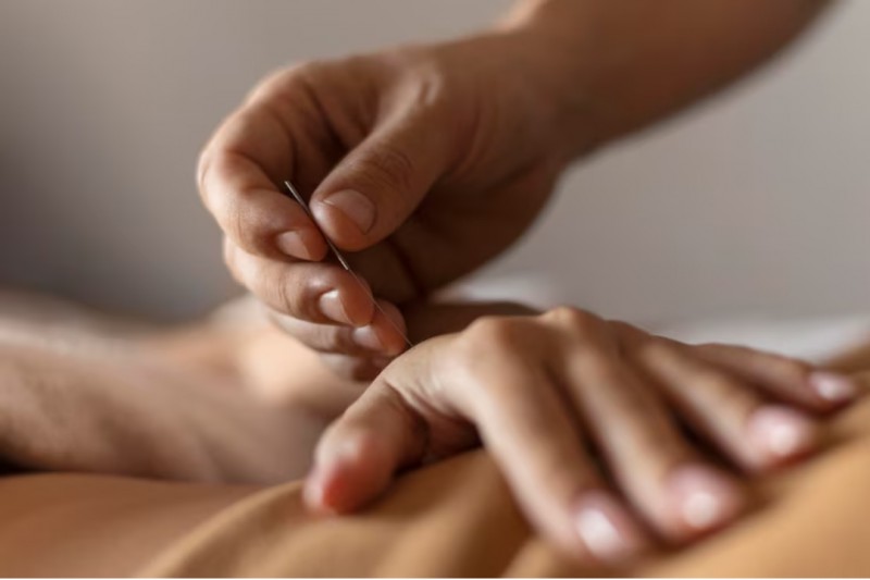 Acupuntura no Tratamento da Depressão Como Essa Terapia Pode Ajudar na Sua Recuperação